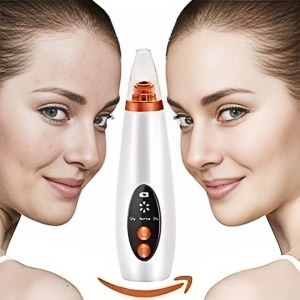 Blackhead Device – Your Daily Glow Companion - MEUTWO